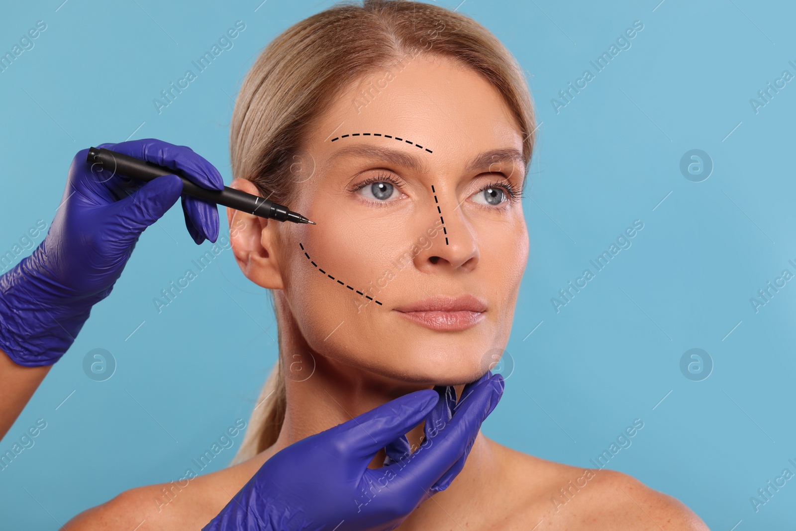 Image of Woman preparing for cosmetic surgery, light blue background. Doctor drawing markings on her face, closeup