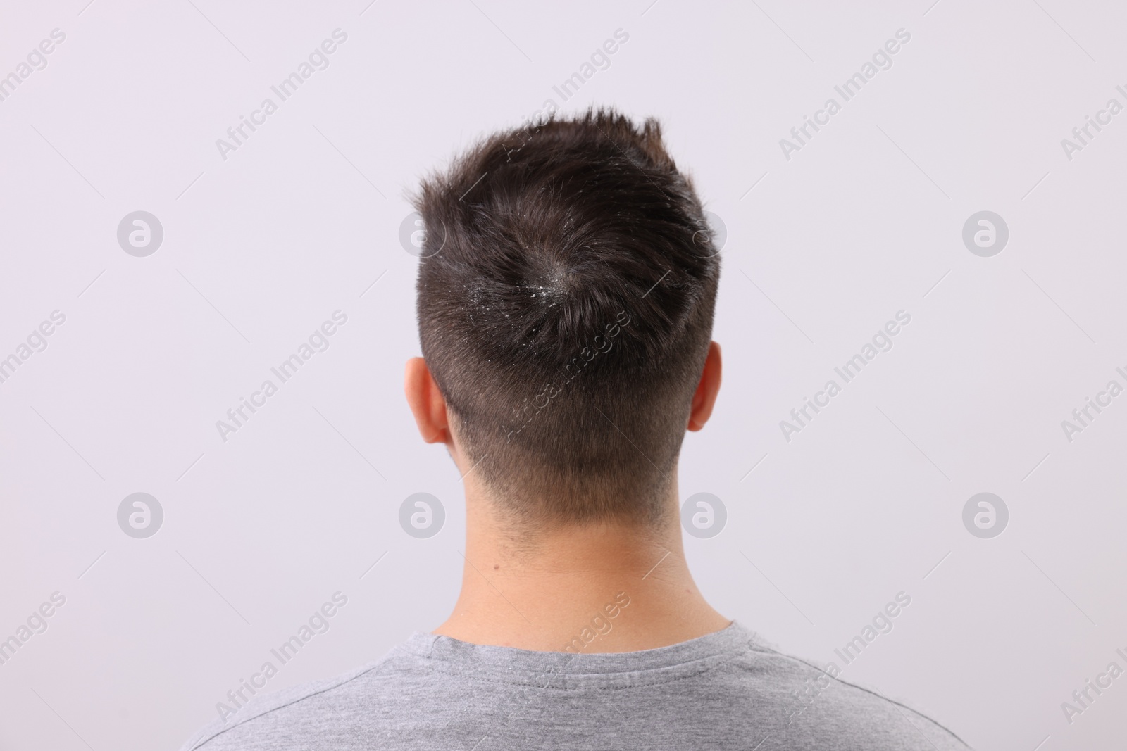 Photo of Man with dandruff in his dark hair on light grey background, back view