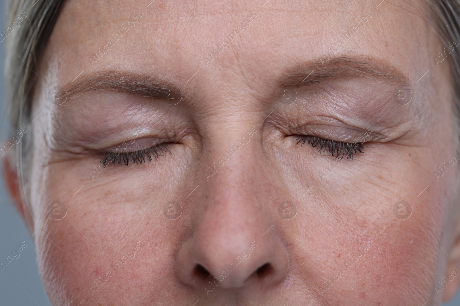 Photo of Senior woman with aging skin on grey background, closeup. Rejuvenation treatment