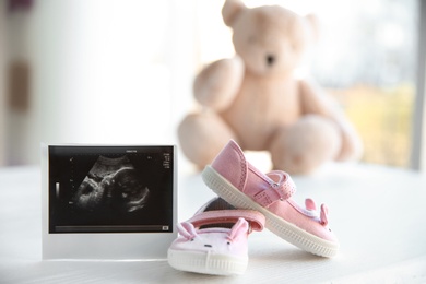 Ultrasound photo of baby and cute boots on table indoors