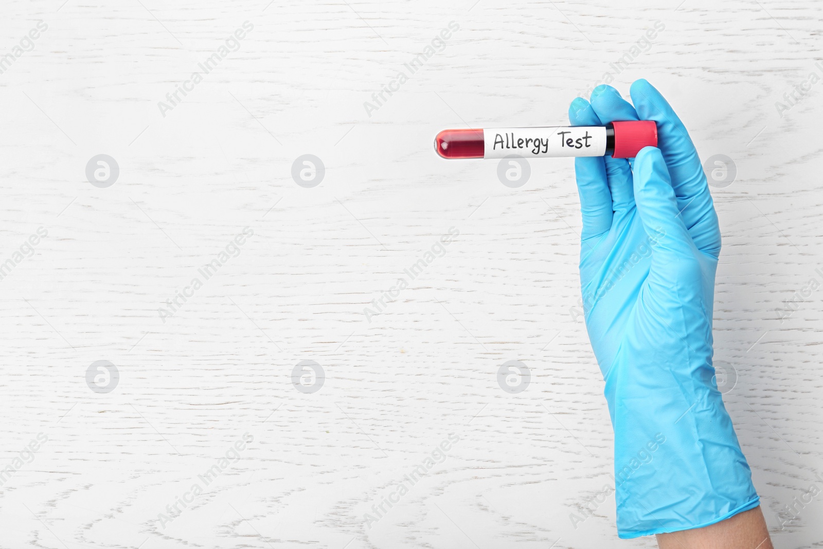 Photo of Doctor holding tube with blood and space for text on light background, top view. Allergy test