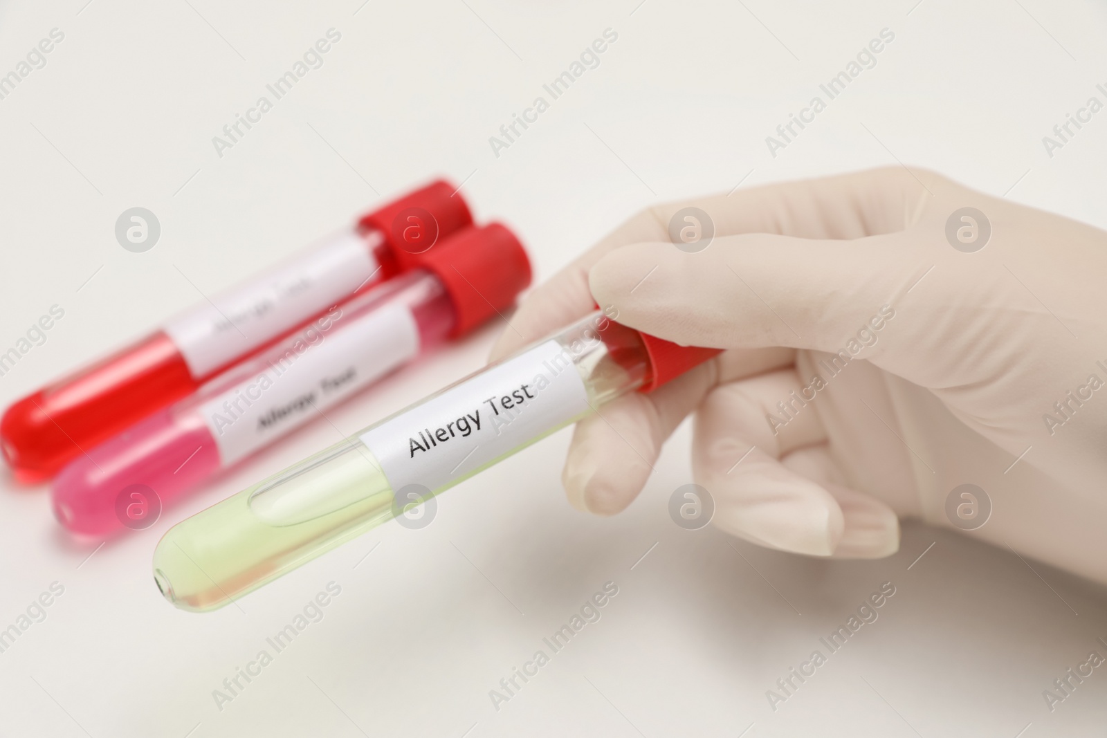 Photo of Doctor holding tube with label ALLERGY TEST on light background, closeup