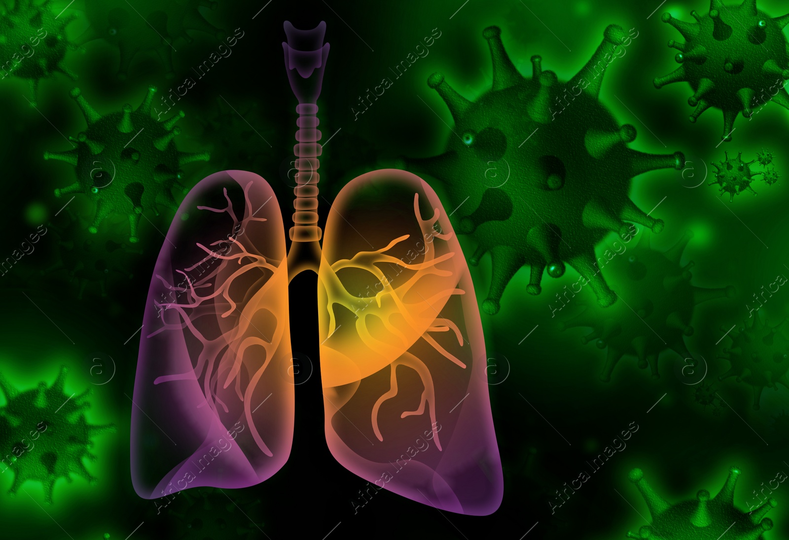 Illustration of  diseased human lungs and viruses on dark background