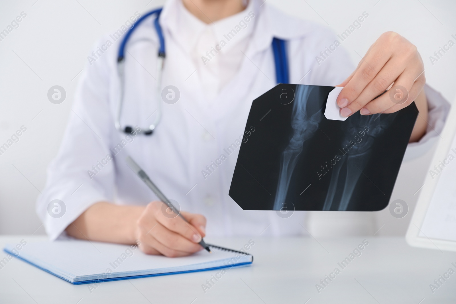 Photo of Orthopedist examining X-ray picture at desk in office, closeup