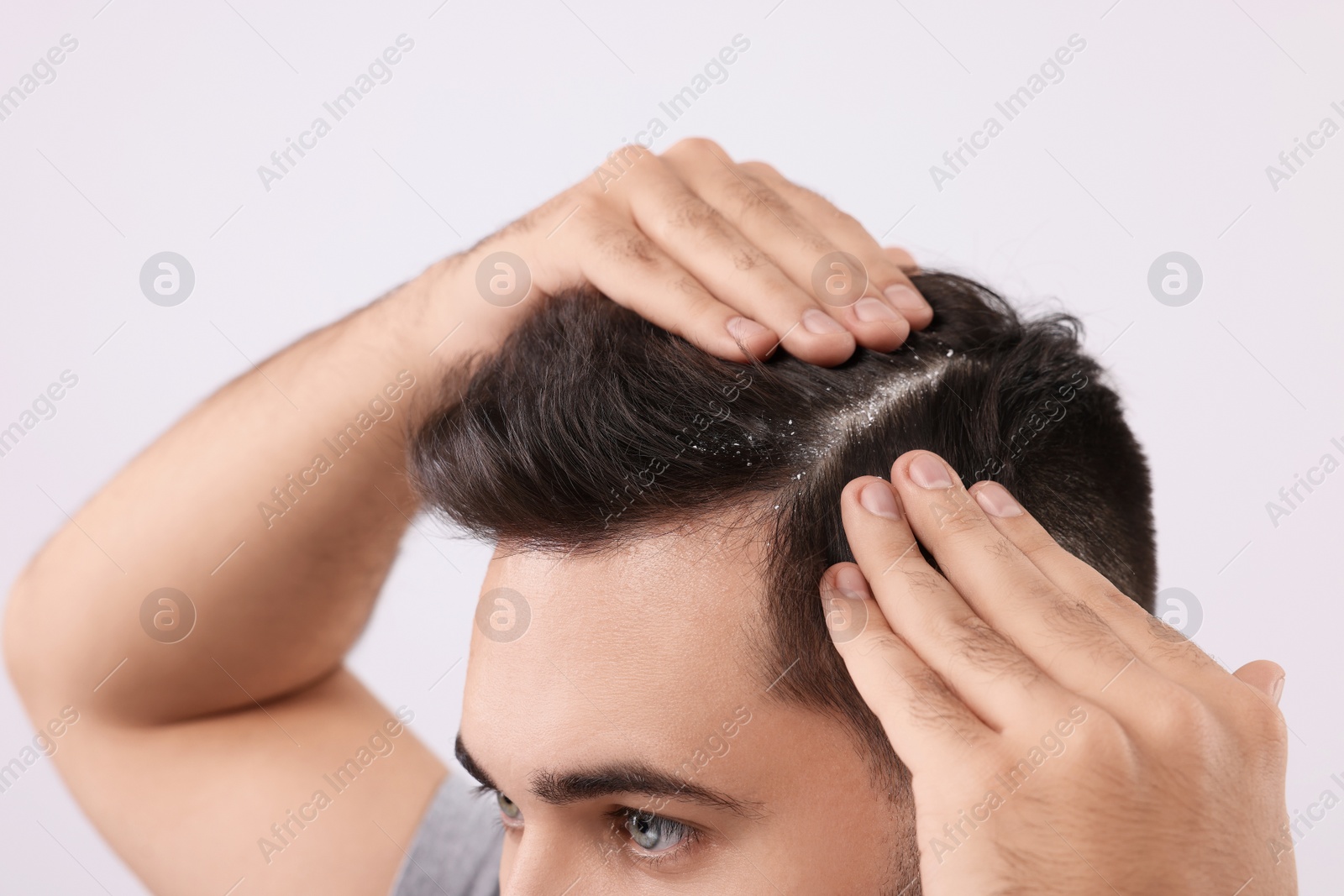 Photo of Man with dandruff in his dark hair on light grey background, closeup