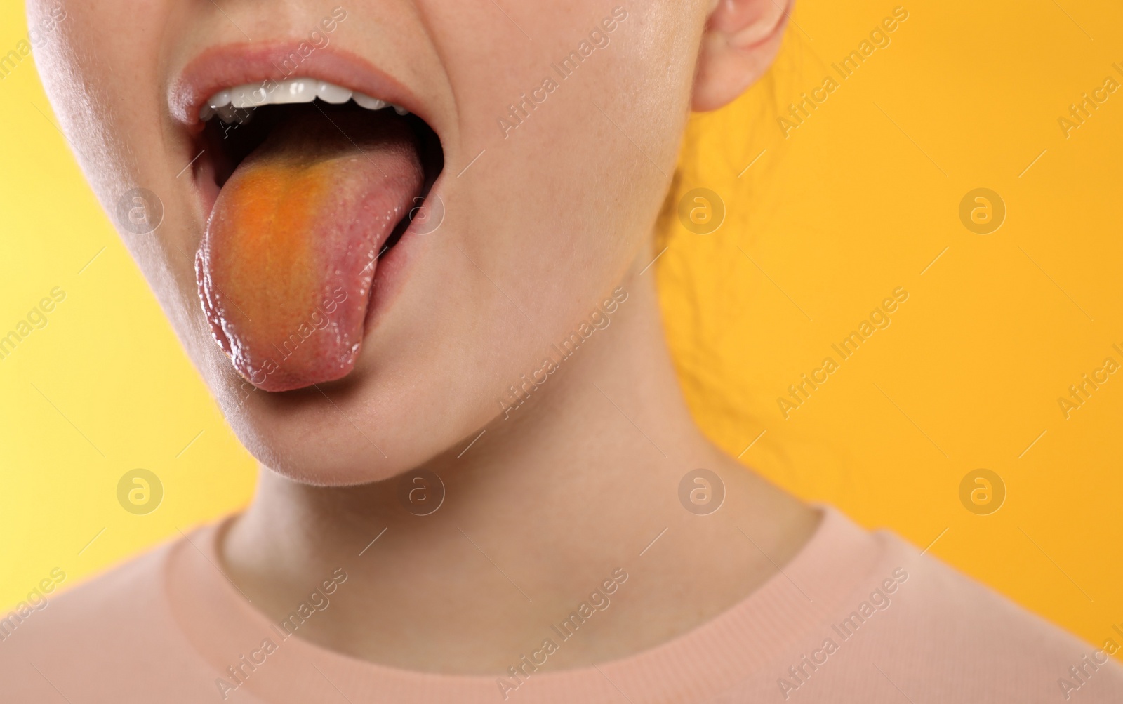 Photo of Gastrointestinal diseases. Woman showing her yellow tongue on color background, closeup