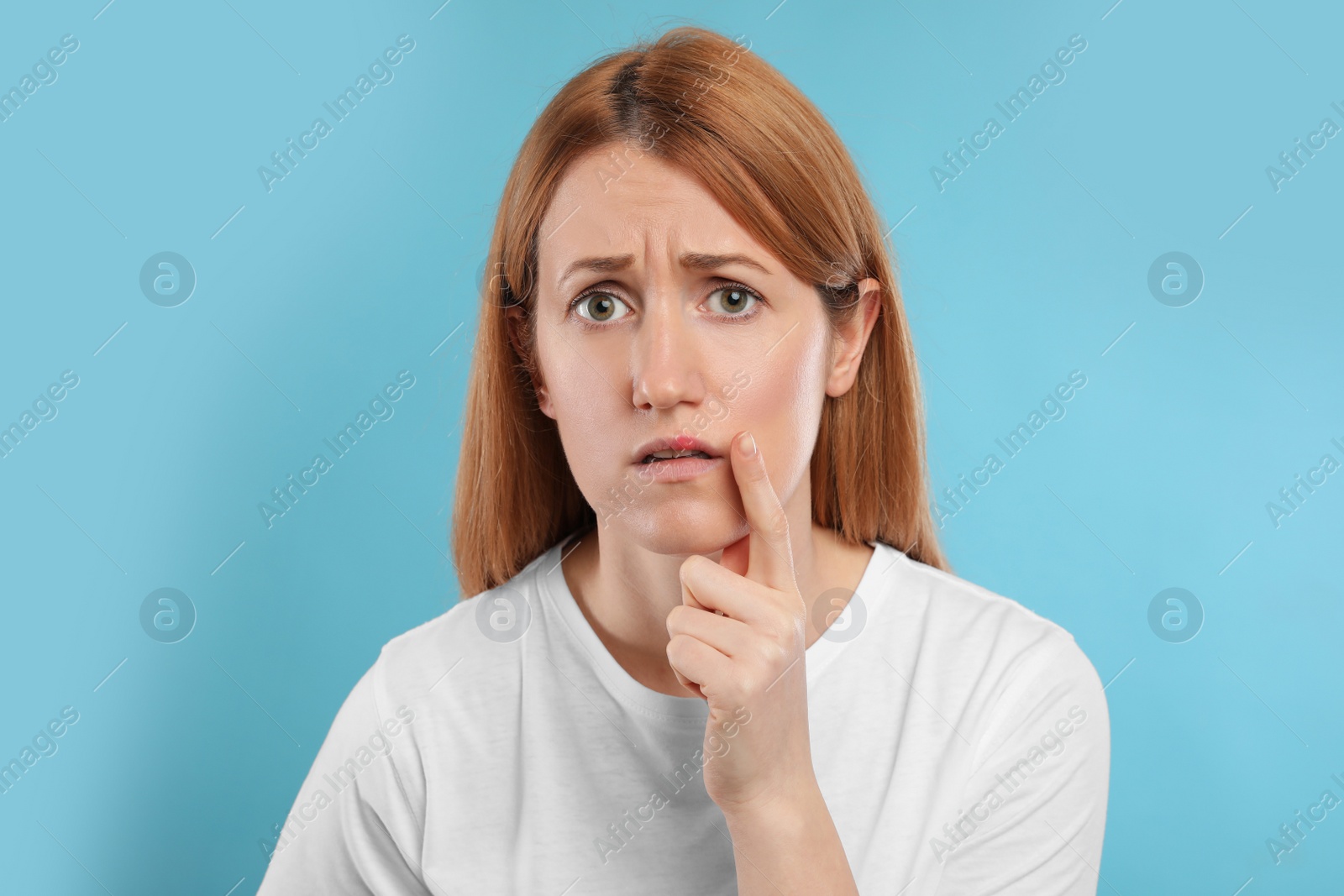 Photo of Upset woman suffering from herpes on light blue background