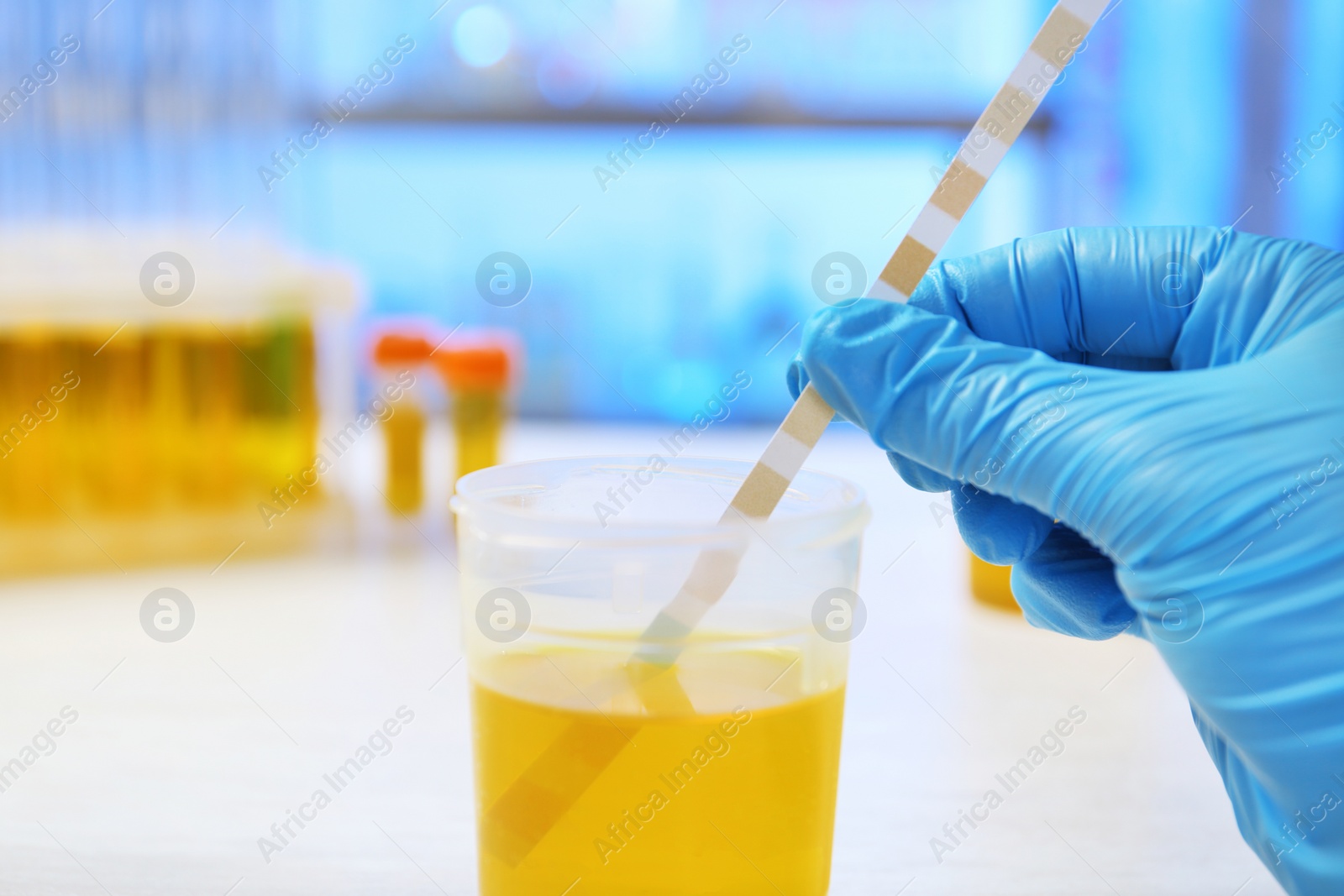 Photo of Laboratory assistant doing analysis with urine sample and litmus paper on table, closeup