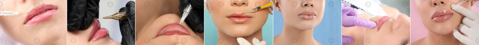 Image of Collage with photos of women during procedures of lip augmentation and permanent makeup, closeup. Banner design