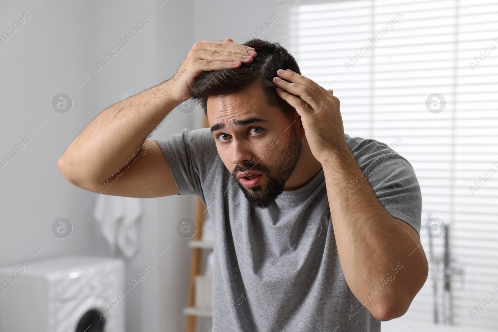 Photo of Emotional man with dandruff in his dark hair in bathroom