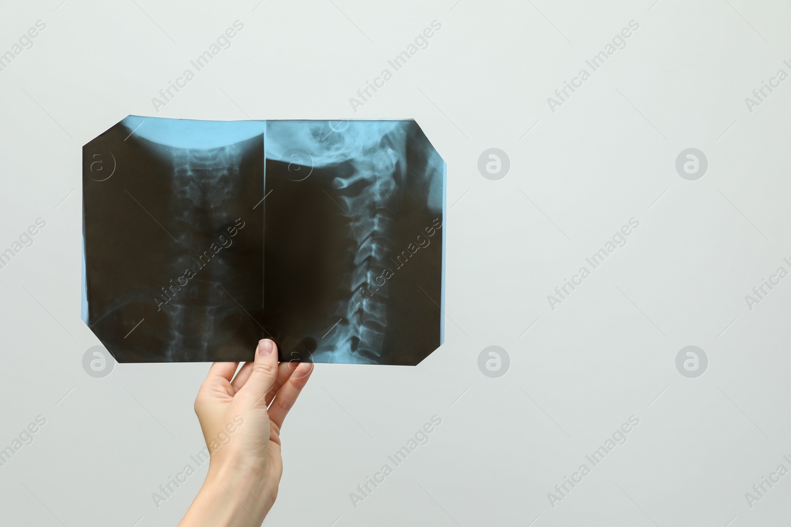 Photo of Doctor examining neck MRI image on light grey background, closeup. Space for text