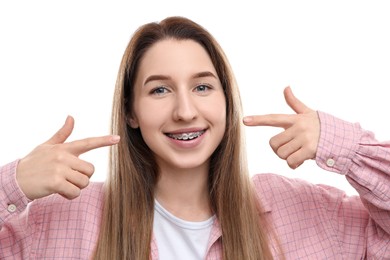 Portrait of smiling woman pointing at her dental braces on white background