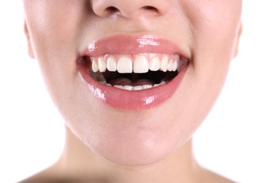 Photo of Young woman with healthy teeth smiling on white background, closeup