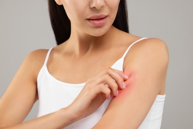 Photo of Suffering from allergy. Young woman scratching her arm on light grey background, closeup