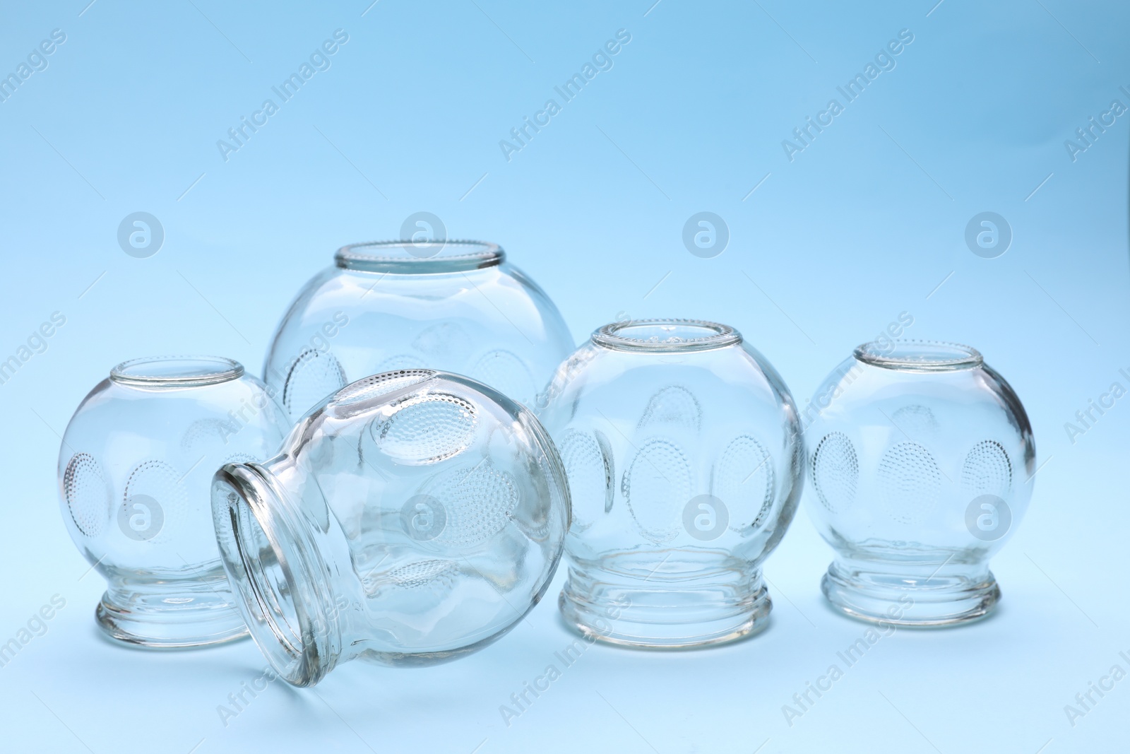 Photo of Many glass cups on light blue background. Cupping therapy