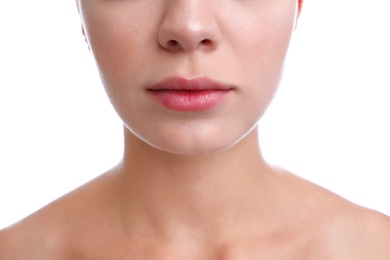 Young woman with cold sore on lips against white background, closeup