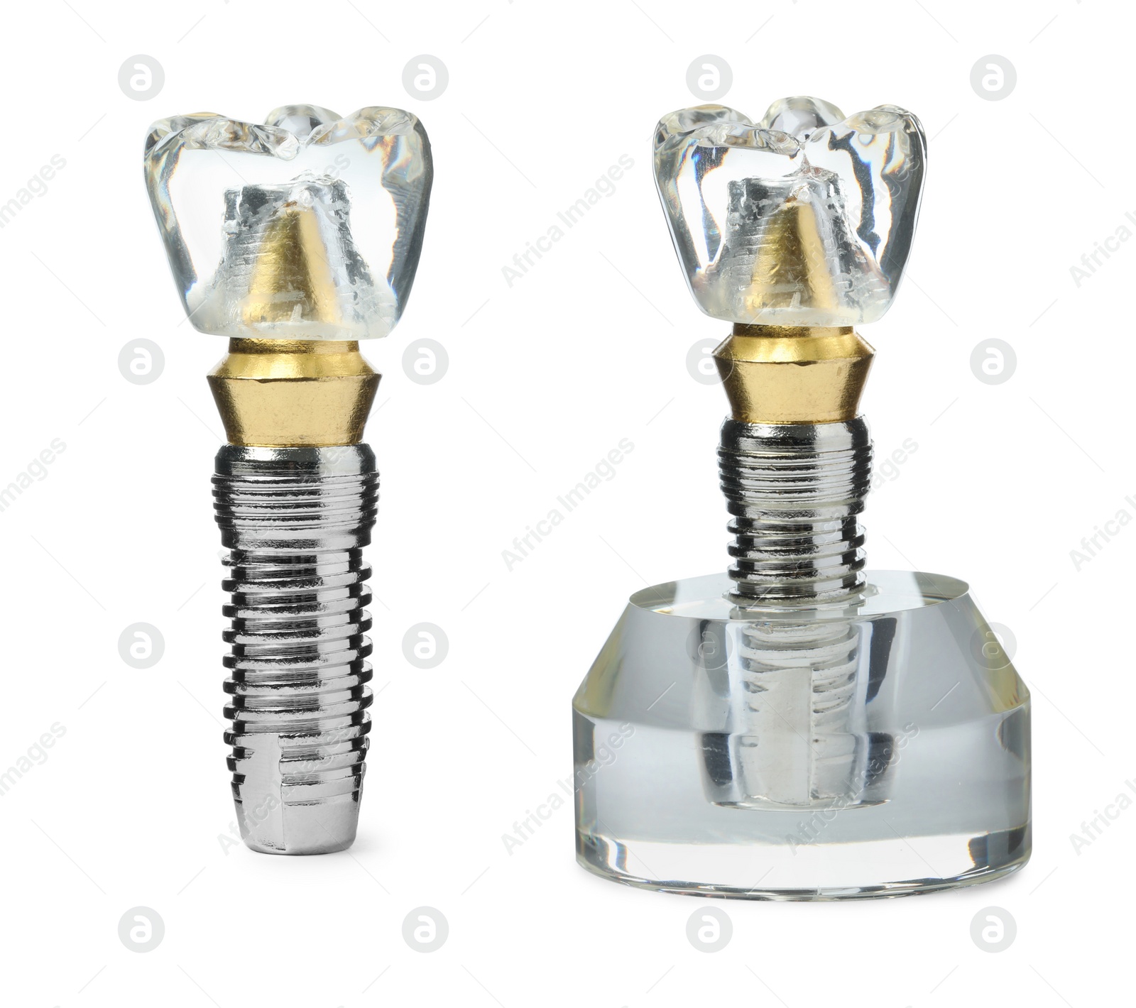 Image of Educational models of dental implants on white background, collage