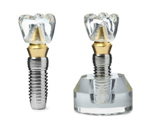 Image of Educational models of dental implants on white background, collage