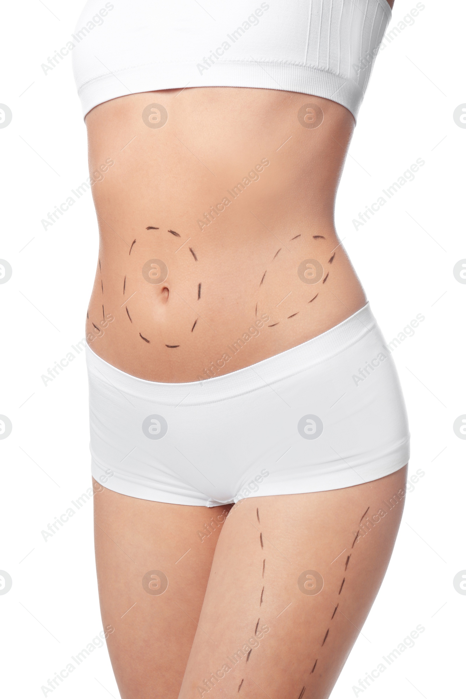 Photo of Young woman with marks on body for cosmetic surgery operation against white background, closeup