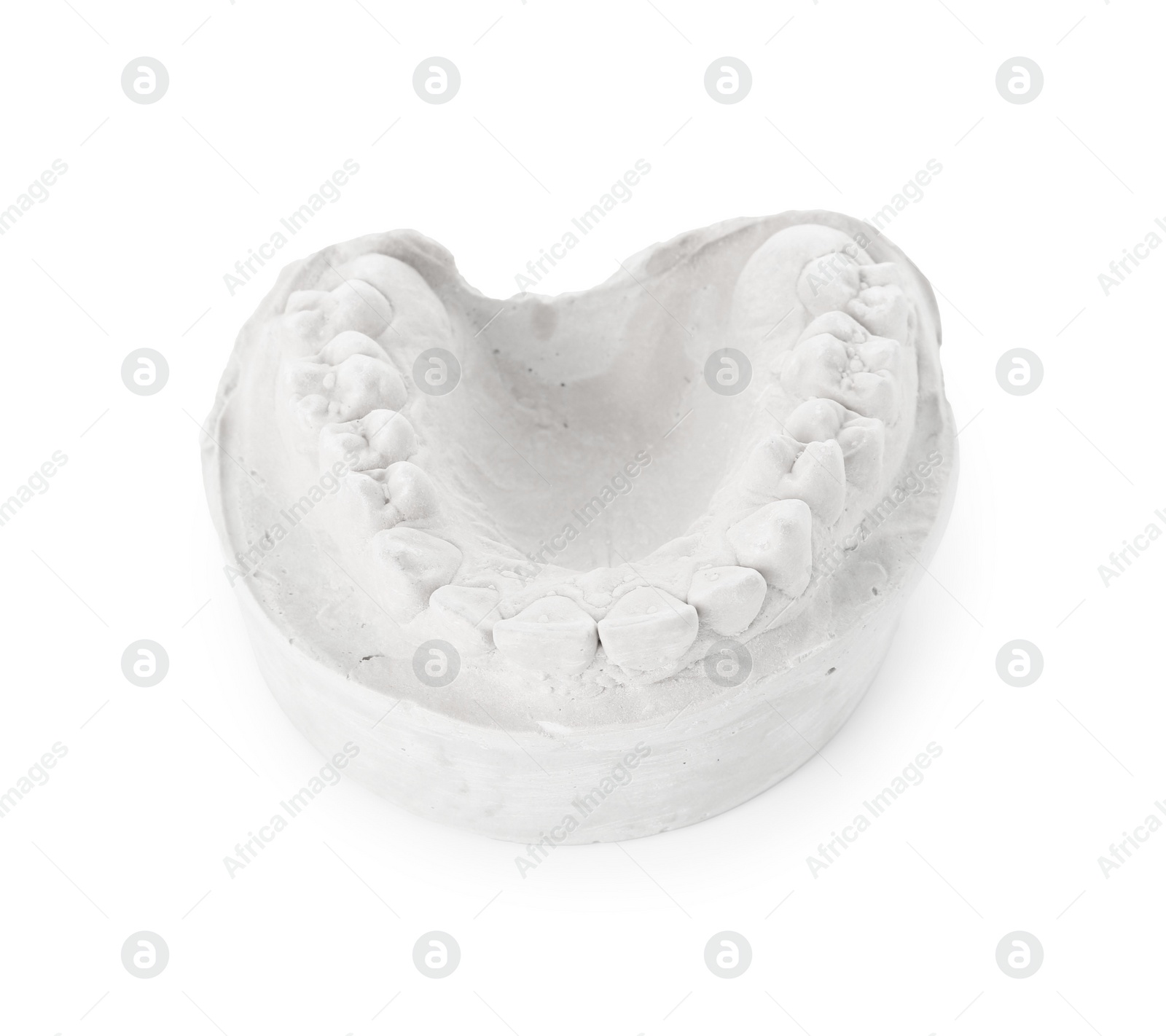 Photo of Dental model with jaw isolated on white. Cast of teeth