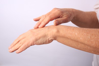 Photo of Closeup view of woman's hands with aging skin