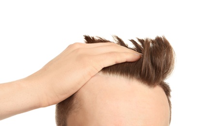 Young man with hair loss problem on white background