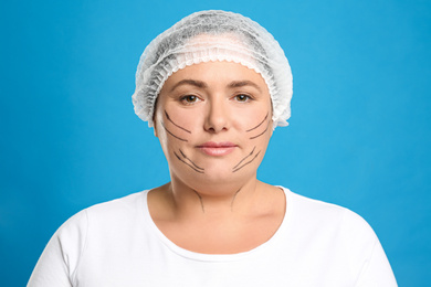 Photo of Woman with double chin ready for cosmetic surgery operation on blue background