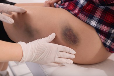 Photo of Doctor examining patient's bruised hip in hospital, closeup