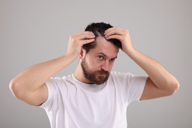 Man with dandruff in his dark hair on light gray background