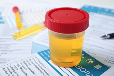 Photo of Container with urine sample for analysis on test form