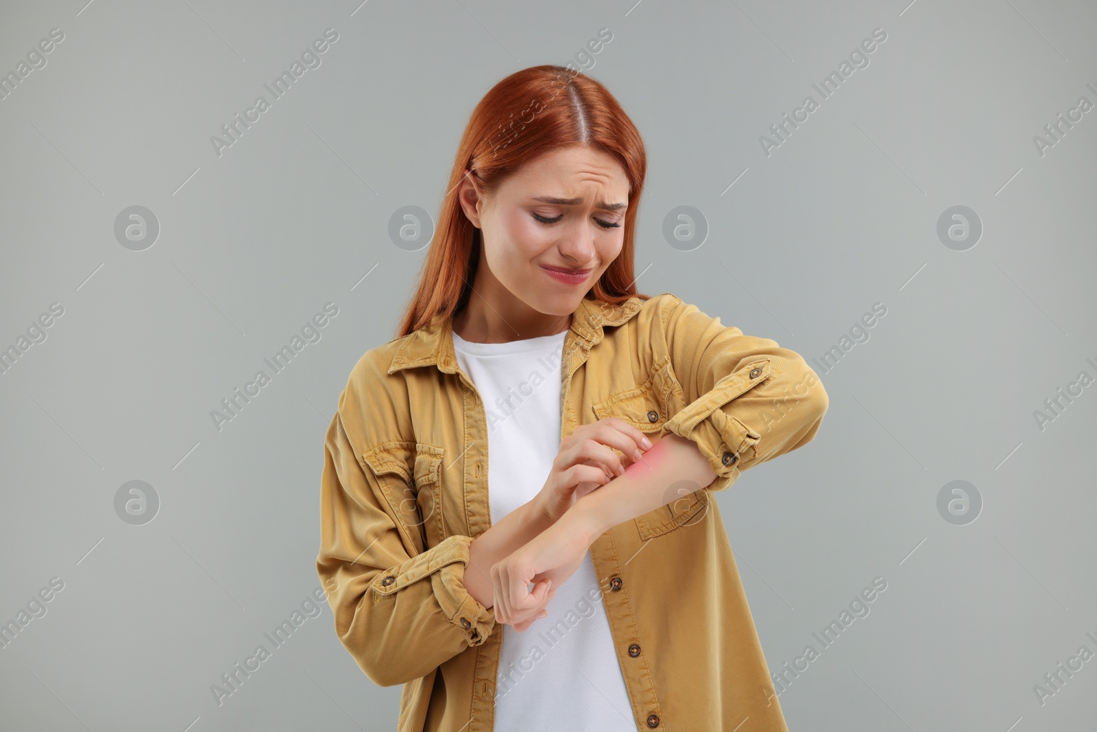 Photo of Suffering from allergy. Young woman scratching her arm on grey background