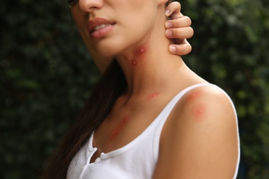 Photo of Woman scratching neck with insect bites in park, closeup