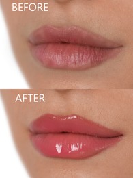 Image of Collage with photos of young woman before and after permanent lip makeup, closeup