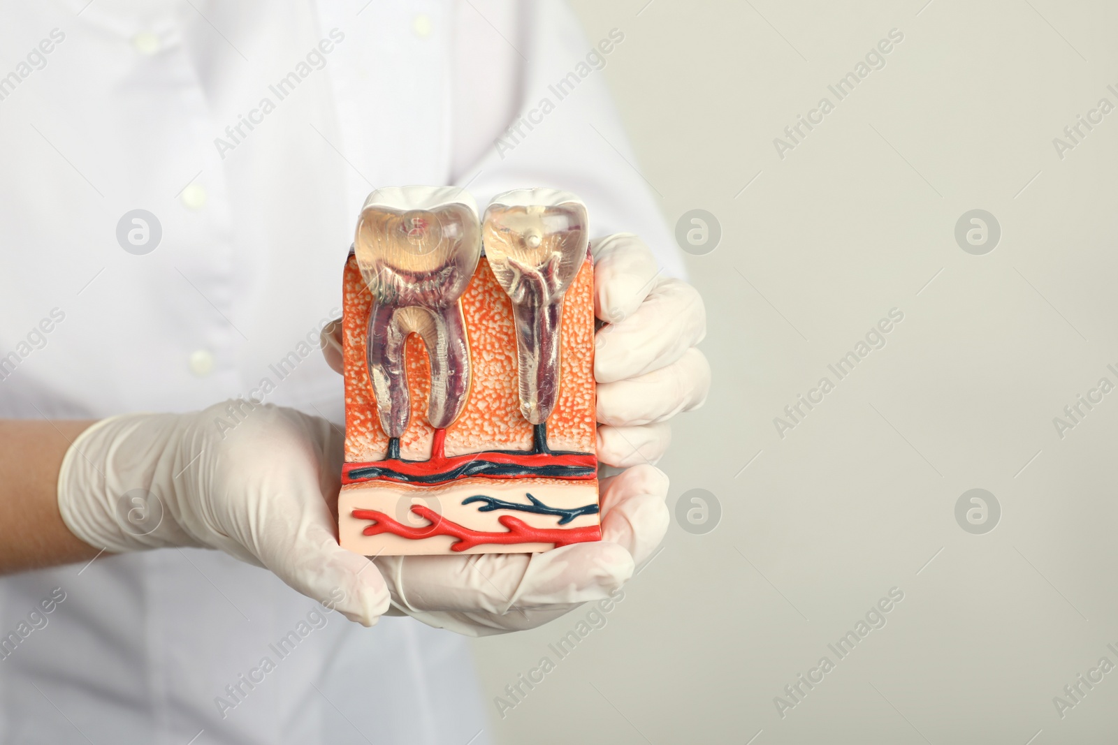 Photo of Dentist holding educational model of jaw section with teeth on light background, closeup