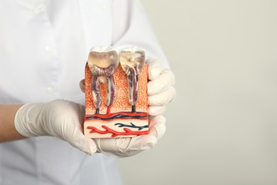 Photo of Dentist holding educational model of jaw section with teeth on light background, closeup