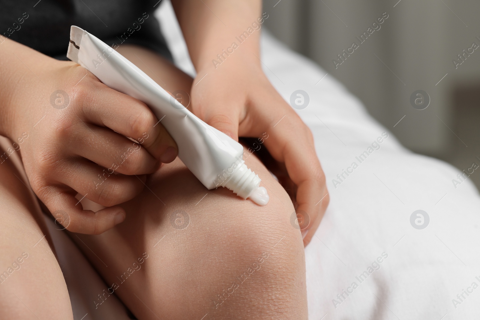 Photo of Child applying ointment onto knee at home, closeup