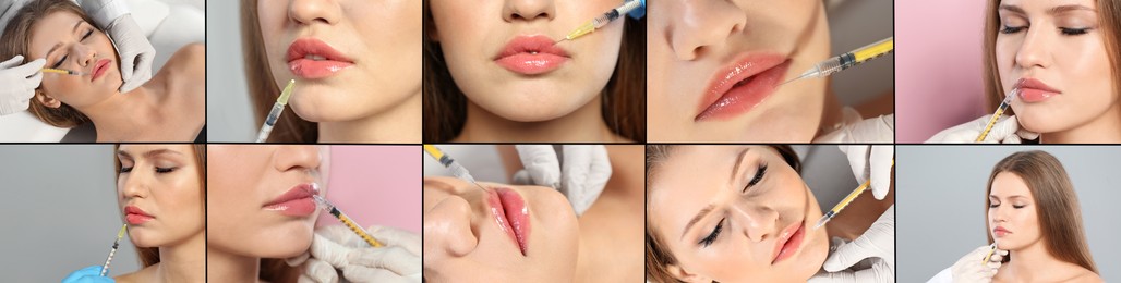 Collage with photos of woman during lip augmentation procedure. Banner design