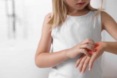 Photo of Suffering from allergy. Little girl scratching her hand on blurred background, closeup. Space for text