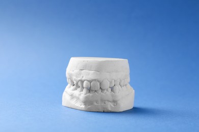 Photo of Dental model with gums on blue background. Cast of teeth