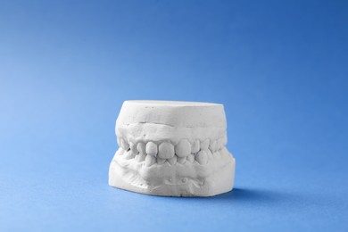 Dental model with gums on blue background. Cast of teeth