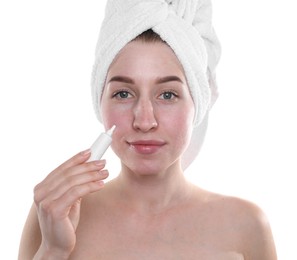 Young woman with acne problem applying cosmetic product onto her skin on white background