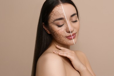 Image of Dry skin treatment. Beautiful young woman before and after procedure on beige background, collage