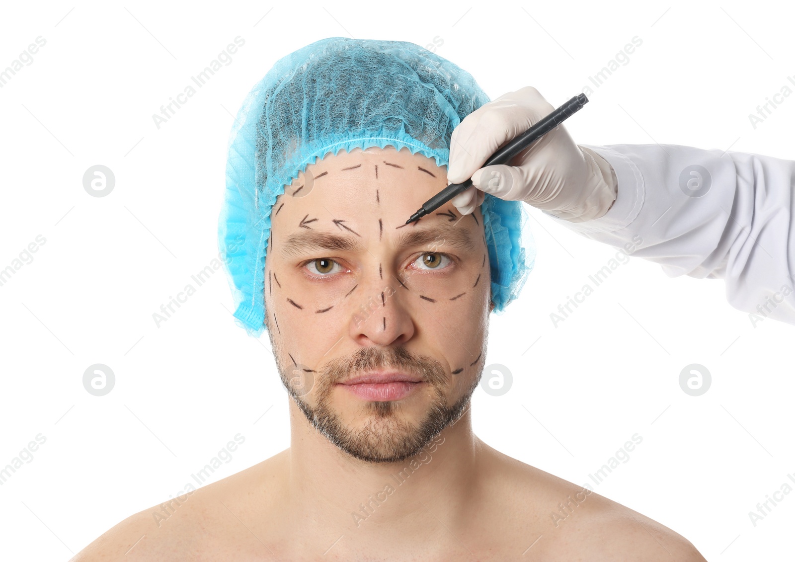 Photo of Doctor drawing marks on man's face for cosmetic surgery operation against white background