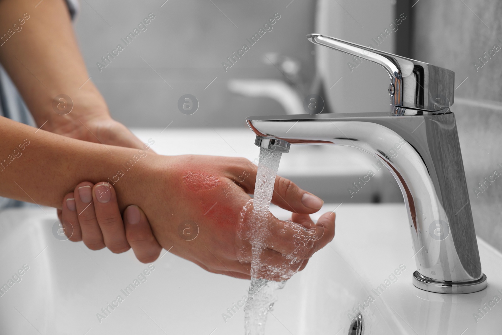 Photo of Woman holding burned hand under cold water indoors, closeup