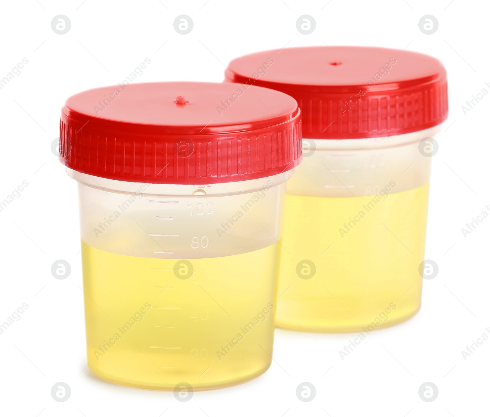 Photo of Containers with urine samples for analysis on white background