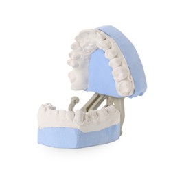 Photo of Dental model with gums isolated on white. Cast of teeth