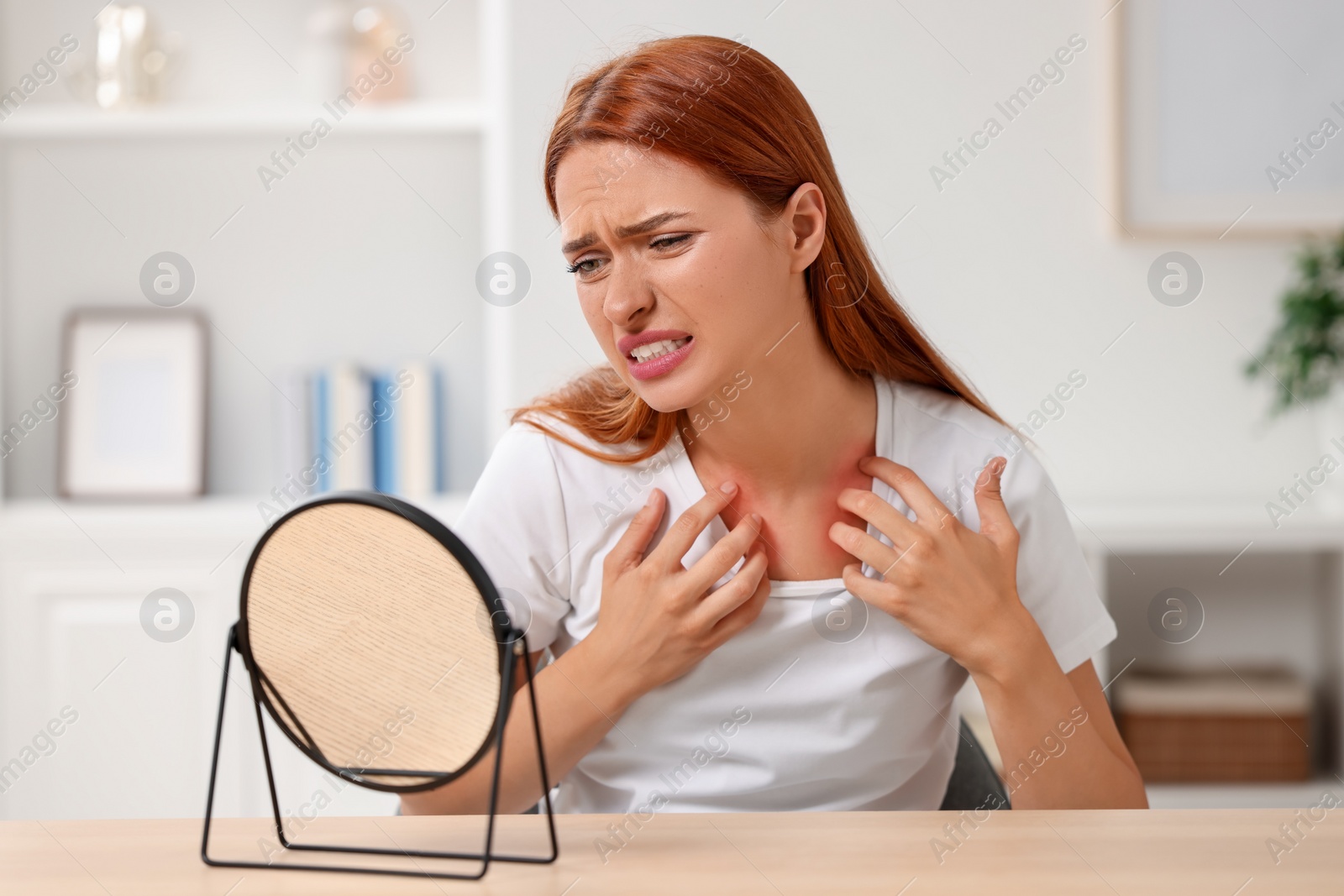 Photo of Suffering from allergy. Young woman looking in mirror and scratching her neck at home