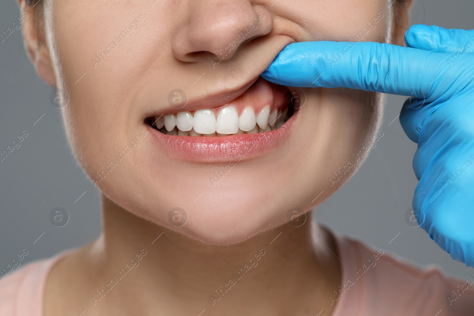 Photo of Woman showing healthy gums on gray background, closeup