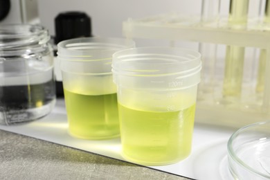Photo of Containers with urine samples for analysis and glassware on grey table, closeup