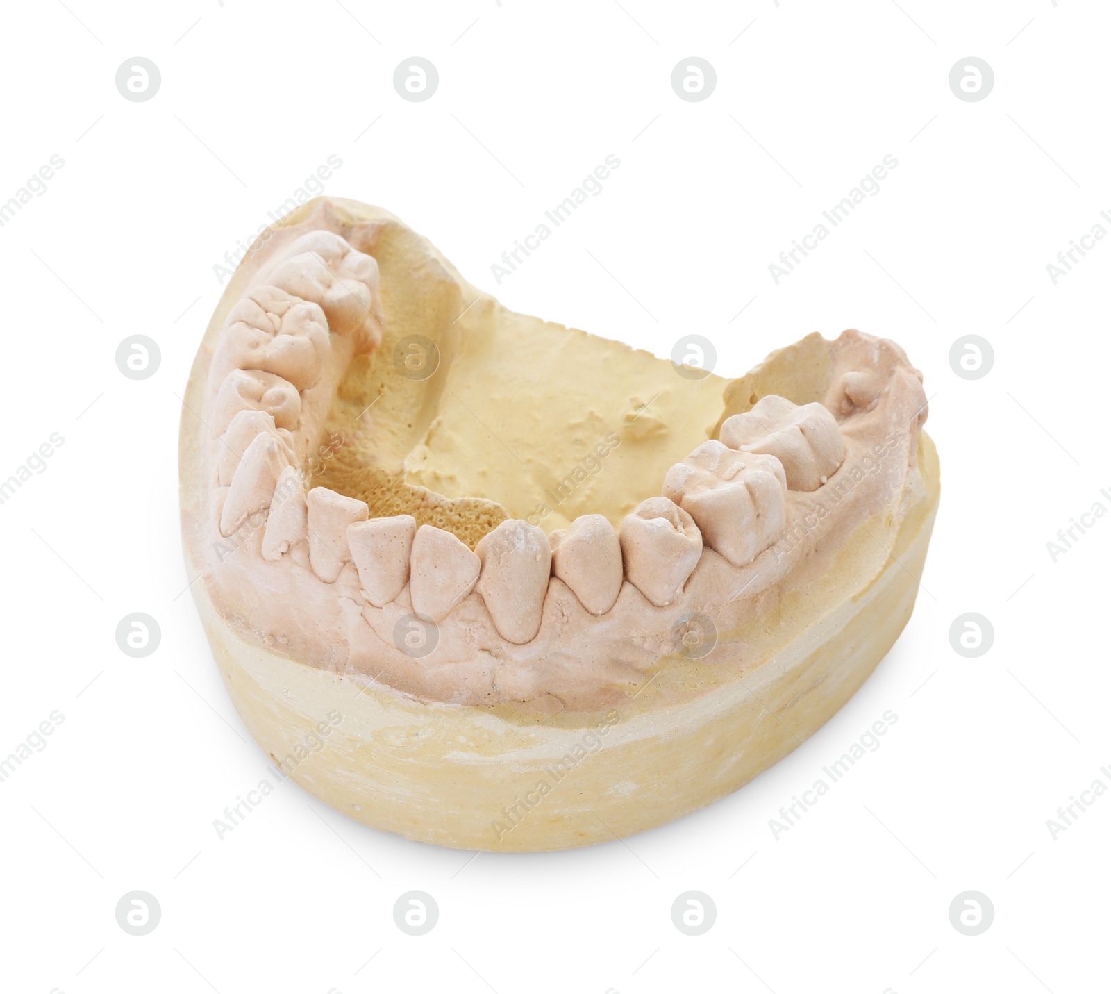 Photo of Dental model with jaw isolated on white. Cast of teeth